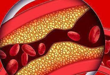 血管|一位男性糖尿病患者的讲述：面对妻子的要求，我自责却又无能为力