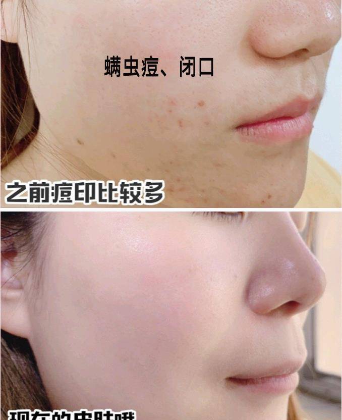 下单|温泉水做的卸妆水,打造“毛孔级”清澈,一擦就干净!