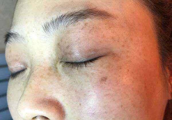 方法|开塞露加它一起敷脸，不出半个月，色斑淡了而且皮肤还白净不少！