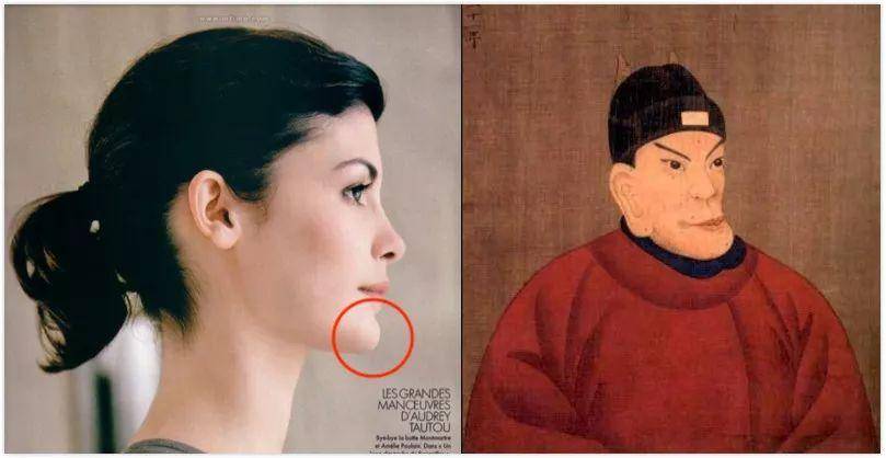 龅牙|广东省全民爱牙行动 地包天需要正畸正颌联合治疗