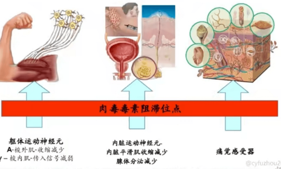 去油|“人类高质量男性”太油腻？肉毒水光去油大法好