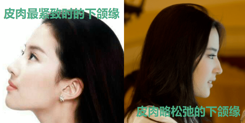眉骨|给赵露思换了天使大宝贝的眉骨和眼眶骨，这张脸洋气指数飙升120%