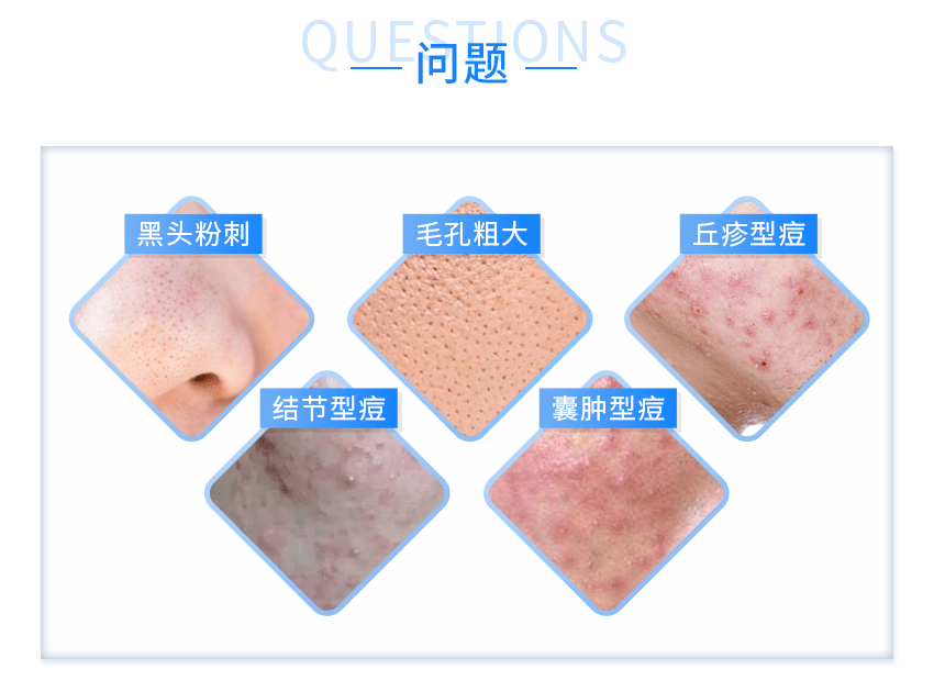 功能|《水初语莹莹护肤课堂》痘痘看1，敏感看2，斑点看3