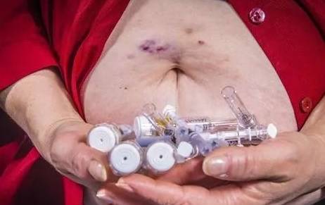 血管|血糖高的人,出现5种表现,小心并发症!控血糖,做好4件事