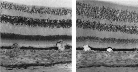 时间|失眠30年、全身莫名疼痛，戒掉这些蔬菜后全好了……