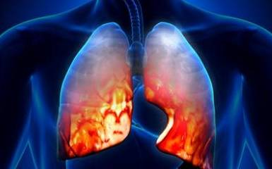 类人|又发现不明原因肺炎,病死率比新冠肺炎还高,这5类人更应该小心