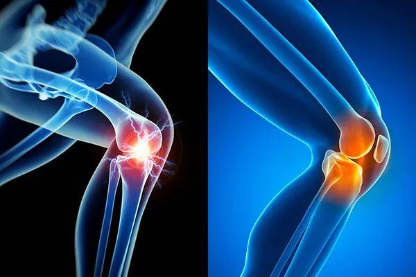 肩颈,膝盖……人体6大关节日常护理技巧