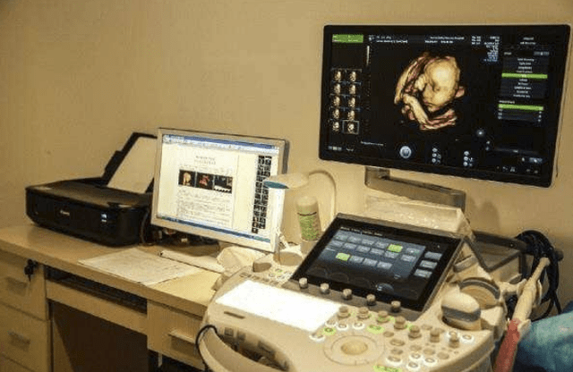 进行|这些孕检项目，二胎孕妈要视其为“眼中钉”，千万不可掉以轻心