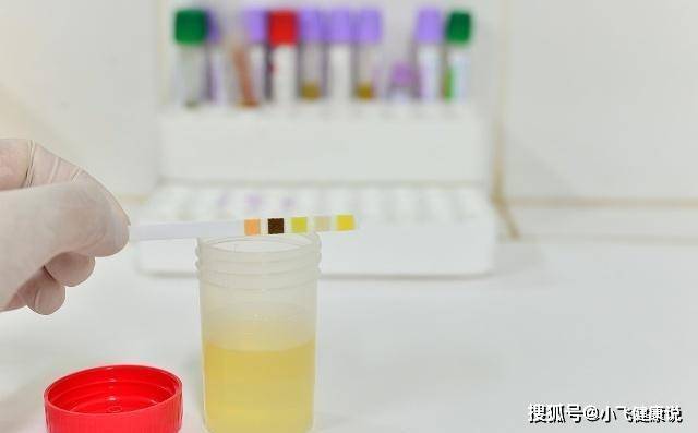生活|糖尿病患者，排尿時出現的此些現象，可能是尿毒癥早期信號