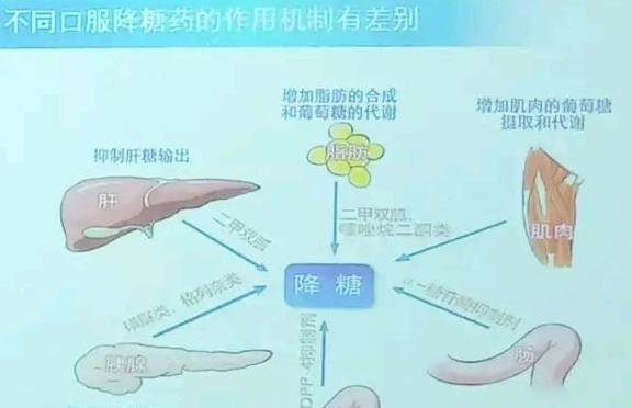 降低|糖尿病用药主要有哪些?专家给你详细解读