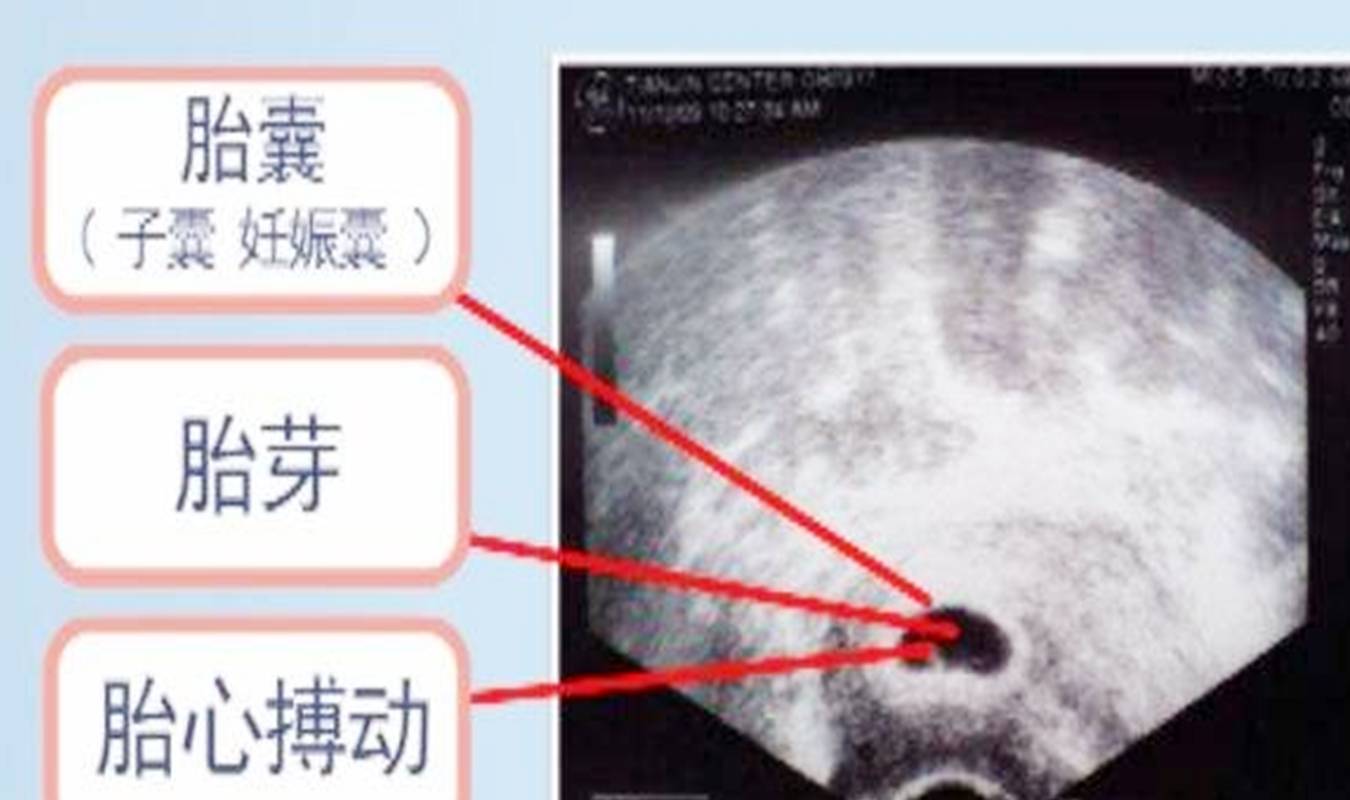 进行|孕期检查多而繁琐，但这几项却不能略过，多花钱总比一无所知要好