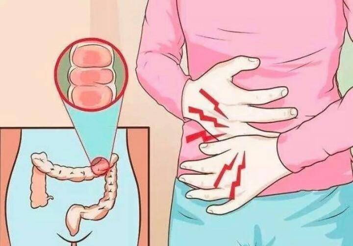 拉肚子要去医院吗？