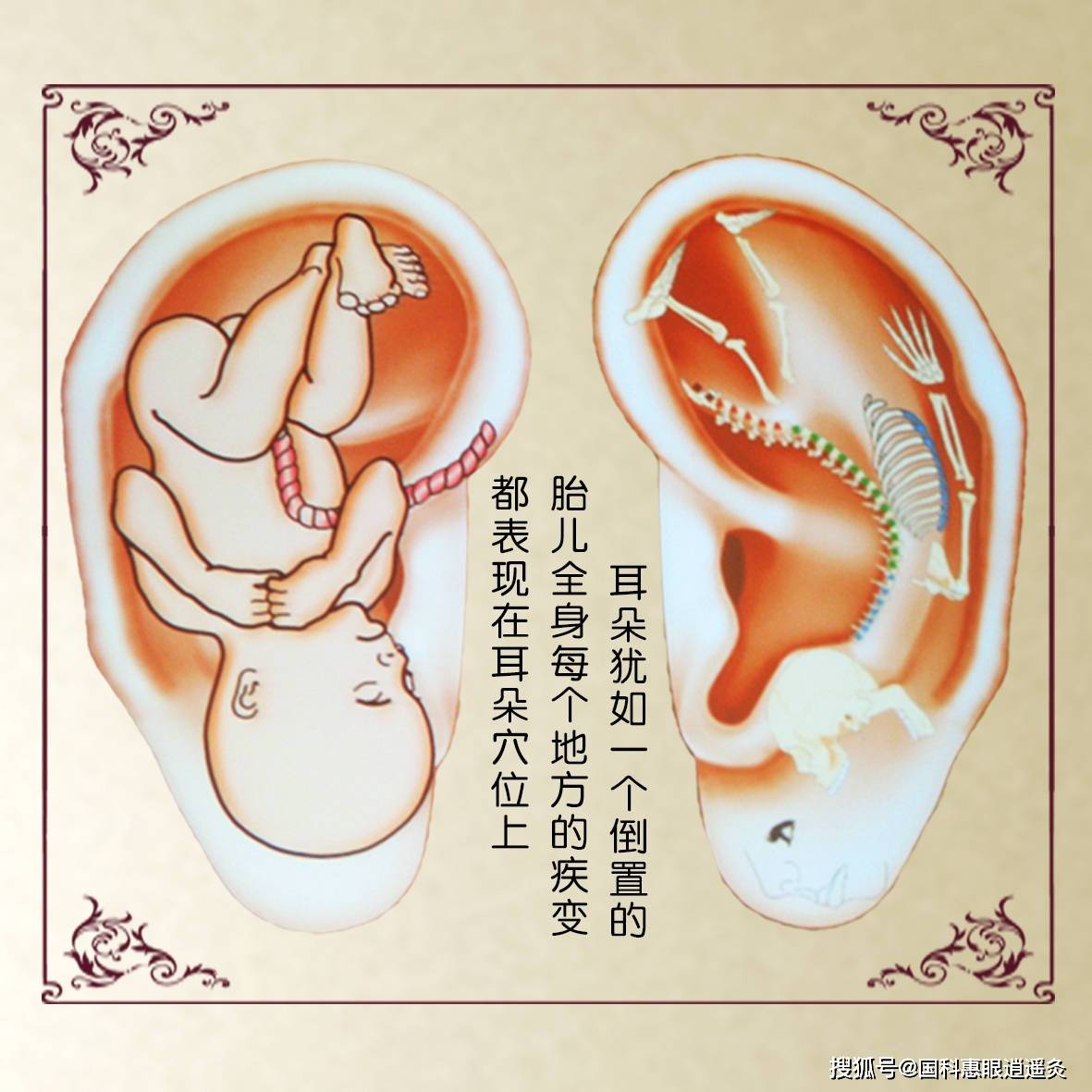 走进中医耳穴疗法，你知道几个呢？毫针法，埋针法，压丸法，逍遥灸！_