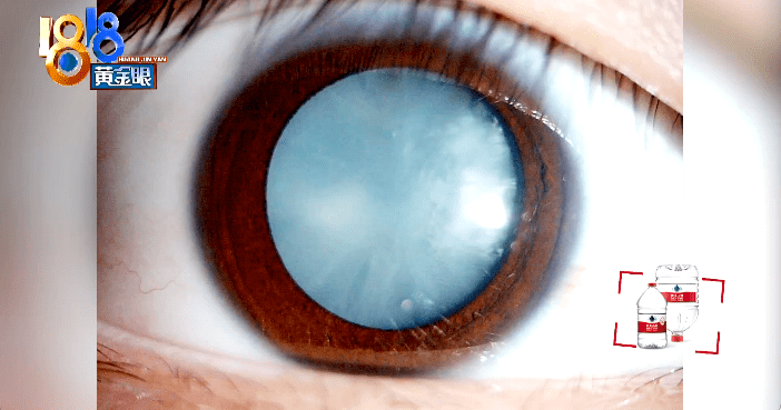 因为|最伤孩子胃的不是炸鸡，不是奶茶，而是这3种食物……（建议收藏）