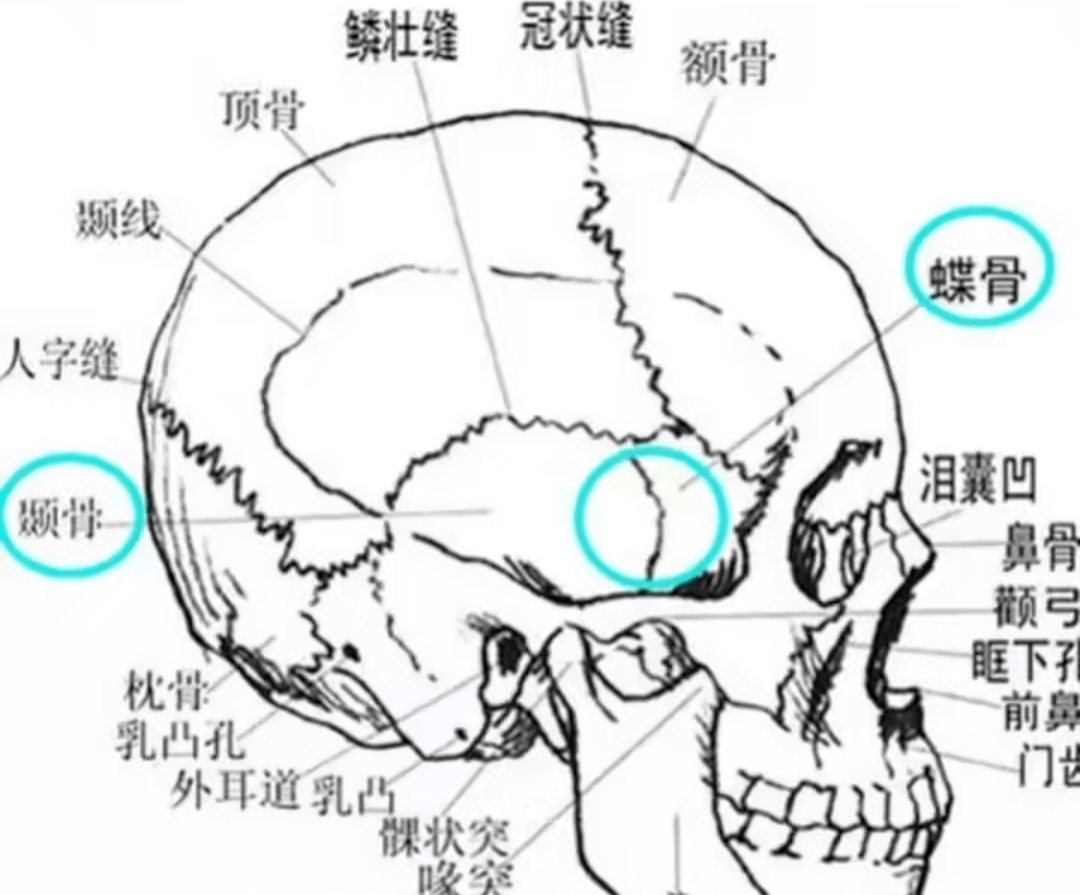 颧骨|太阳穴凹陷也分真性假性？颧弓内推还是填充？