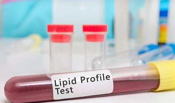 水平|血脂的正常范围是多少？这几个指标，你可别超了