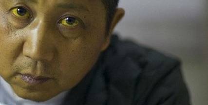 肝脏|肝病多数是“拖”出来的，出现8种表现，最好去查一下肝功