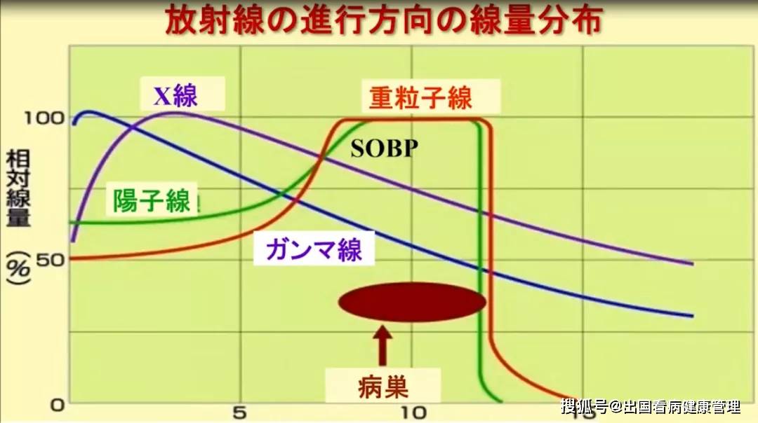 质子重离子治疗 光免疫疗法 溶瘤病毒疗法 一文了解日本抗癌新技术 中子