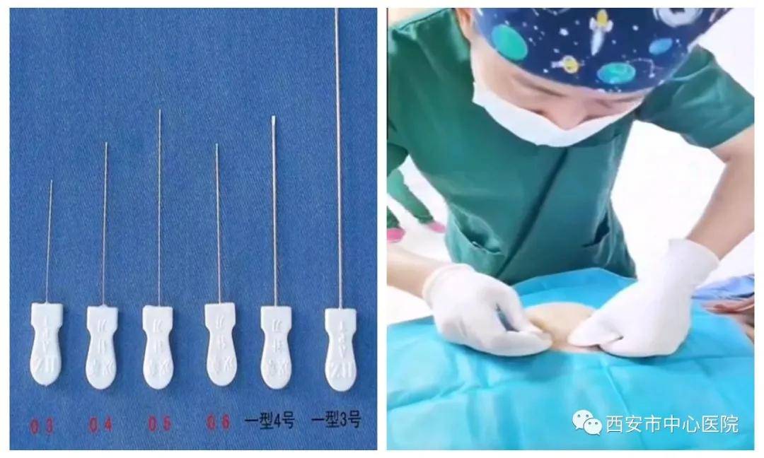 病房|西安市中心医院疼痛科——全新住院病房正式投入使用