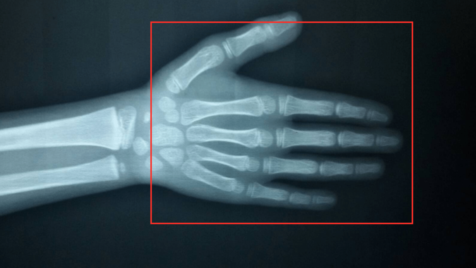 薯条|从小爱吃炸鸡、薯条，8岁长小胡子，14岁身高定格在160厘米