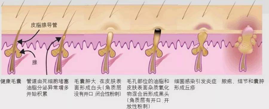 人体|葛林若｜清洁皮肤的学问one