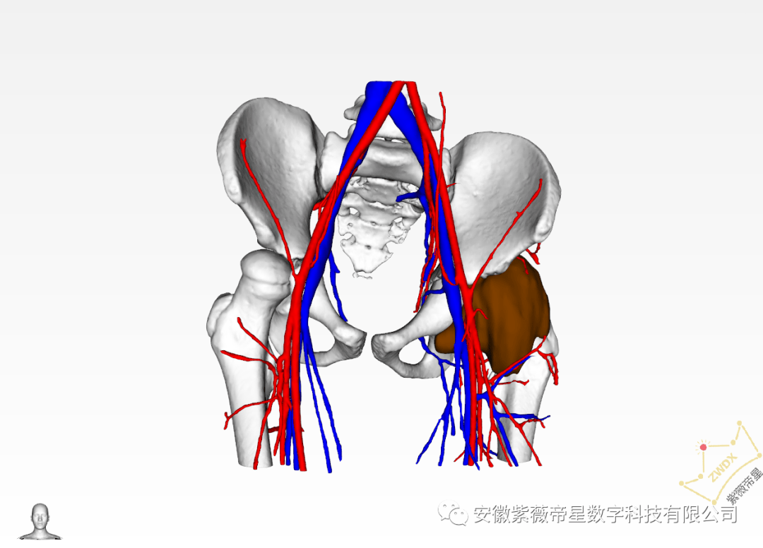 姐弟俩查出髋关节发育不良,儿医专家运用"黑科技"让手术更加精准