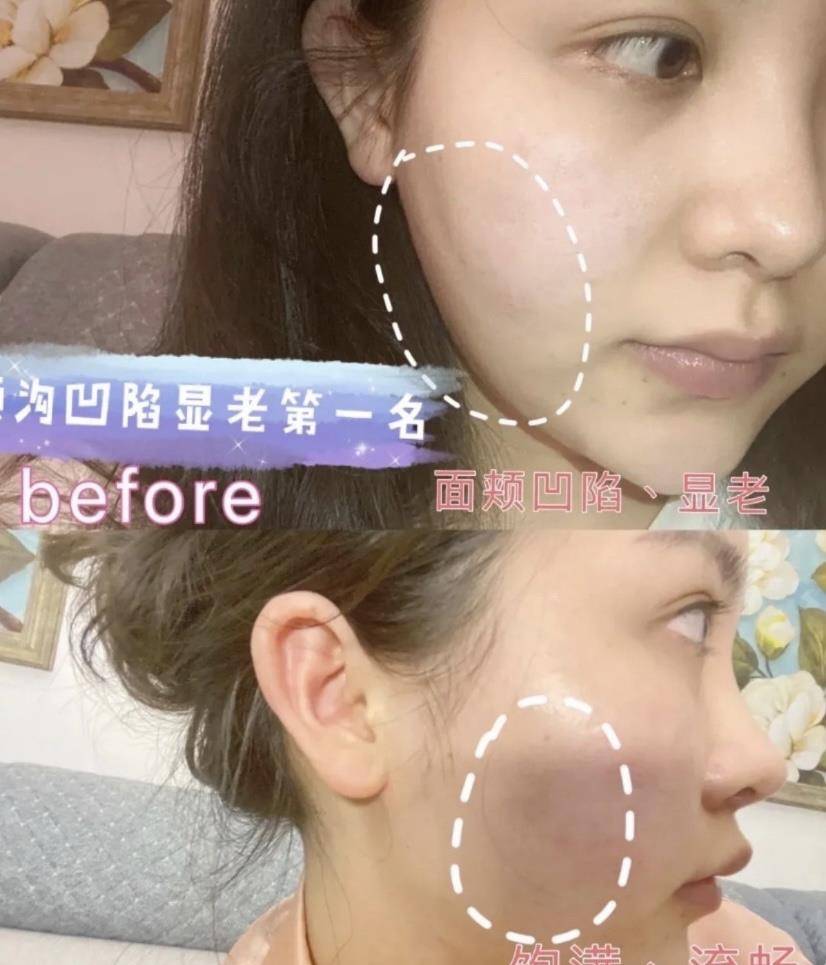 缺点|盘点2021年上半年我做过的皮肤项目！