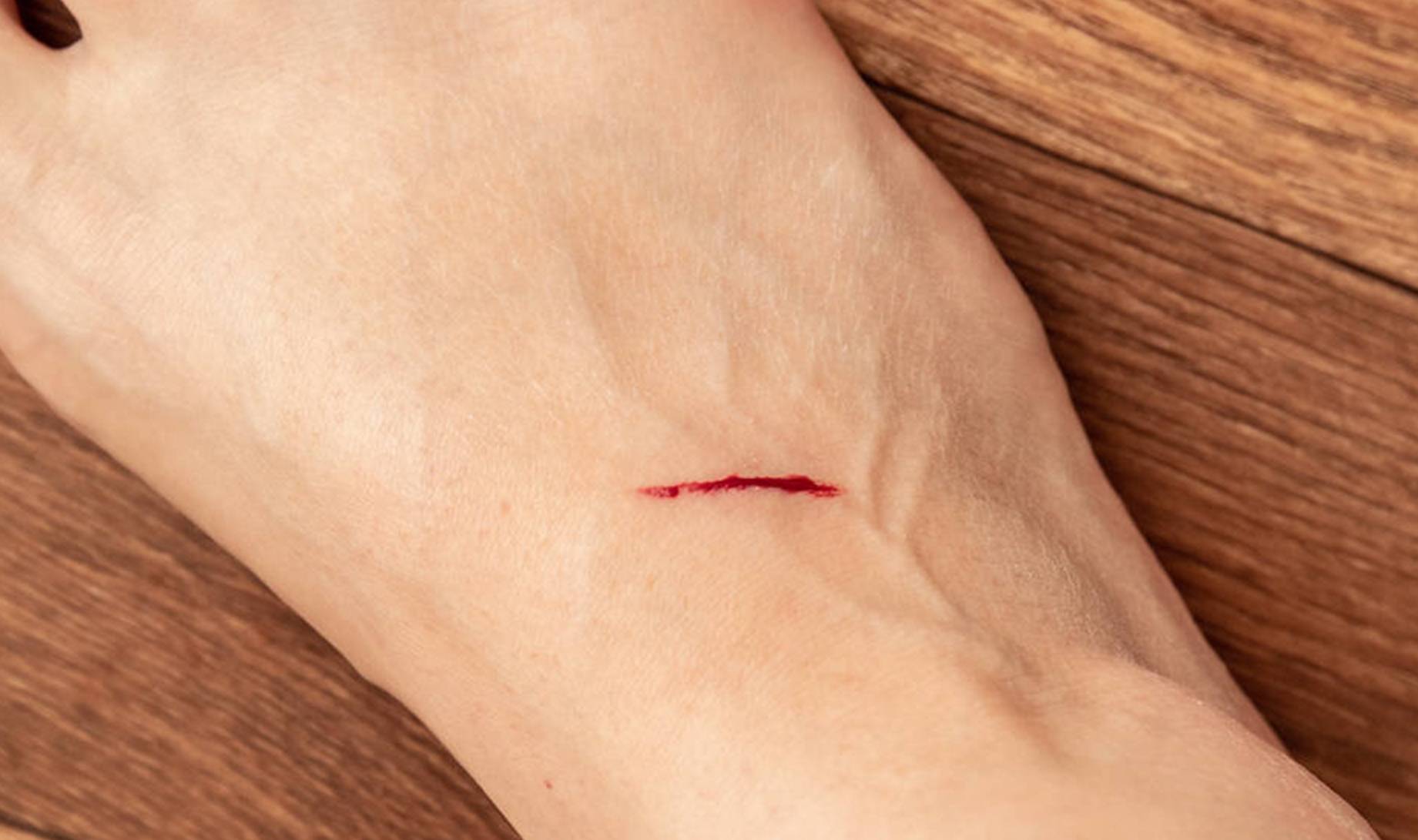 血液|血糖超标，“脚”知道！脚部若没有出现4异常，祝贺，血糖很稳定