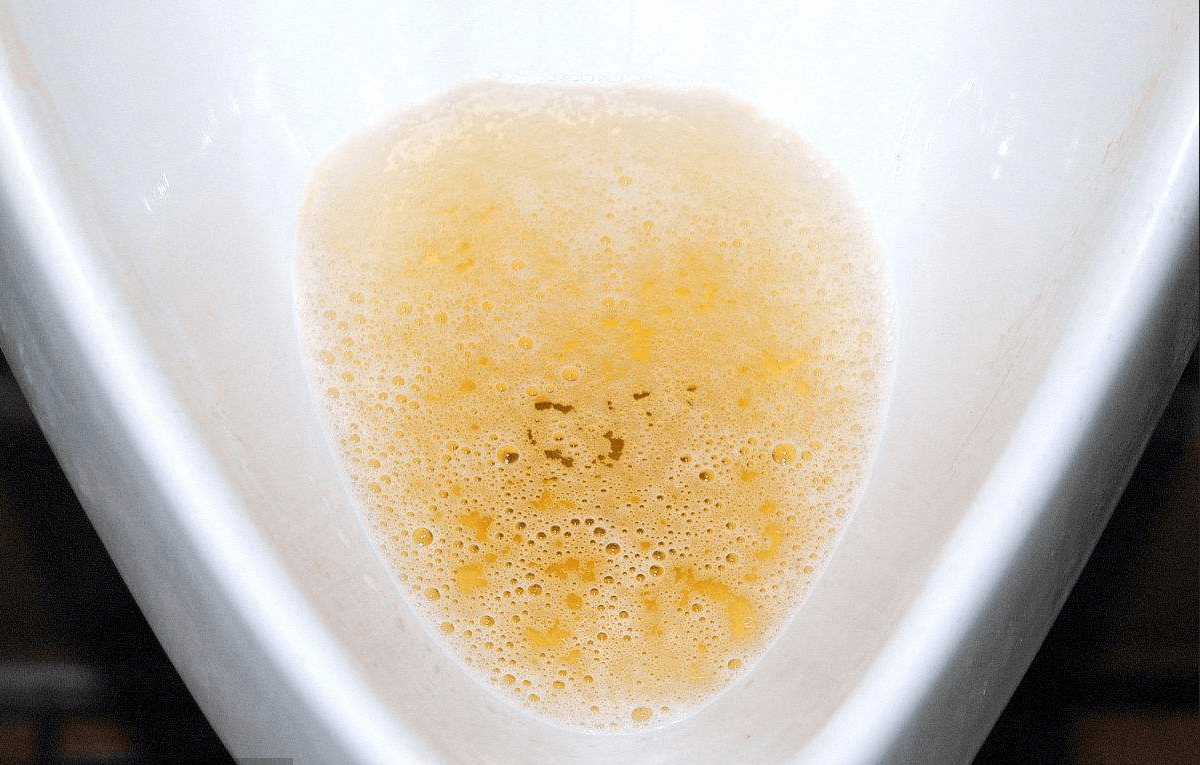 治疗|乙肝脸上会出现3种症状,中医用“土方子”,让你跟乙肝说拜拜