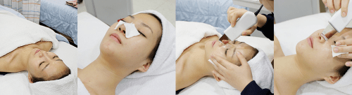 鼻子|view韩国鼻子修复手术6个月内忽略这些事儿手术白做了！