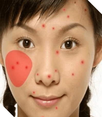 下巴|秋秋老师--