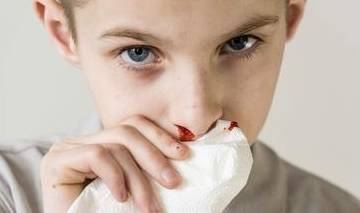 什么原因会引起流鼻血 c39568fbd18d4a7fa26ca91e3fcfd3db.jpeg