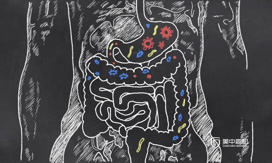 症状|小心“阑尾炎”背后隐藏的杀手—— 阑尾癌！