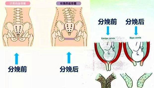 时间|10个产妇9个腰酸背痛？孕期与坐月子的7大细节，让宝妈无月子病