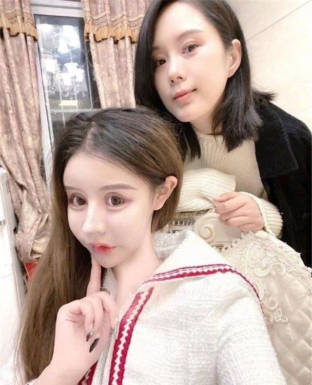 人间|13岁女孩为变漂亮,3年整容60次成小网红,自称是人间芭比