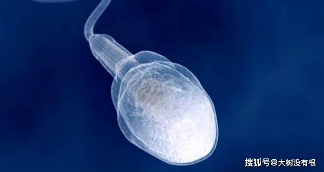 我们经常把精子比喻成小蝌蚪,这是因为精子的形状与小蝌蚪十分相似,都