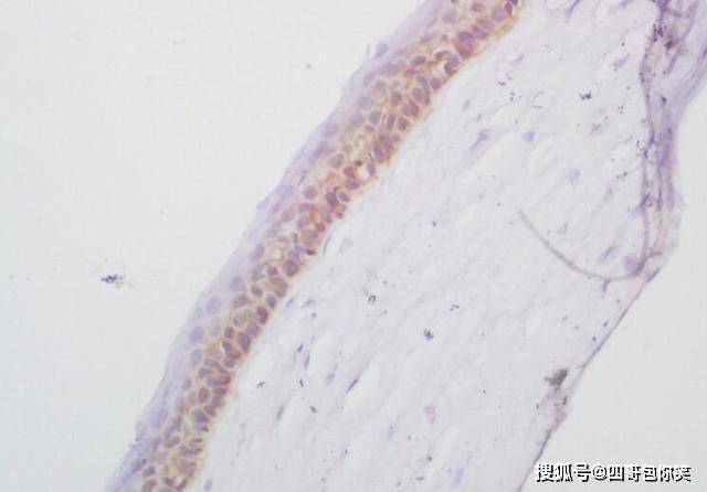 毛囊|白头发拔一根长十根？科学家告诉你真实原因