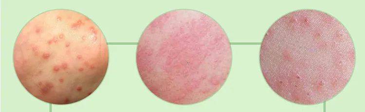 黑色的了,这可能是在提示你已经坐得太久了,已经伤害到臀部健康了