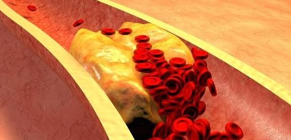 蔬菜|早上是养肝“黄金期”，坚持吃3类早饭，肝会对你“感激涕零”