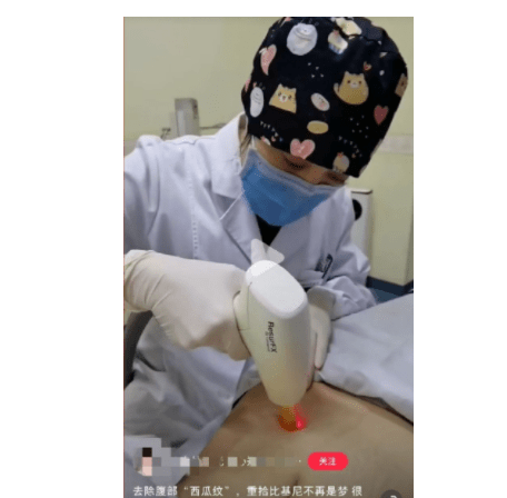 产品|妊娠纹也是“看碟下菜”？教你如何有效淡化妊娠纹，少交智商税！