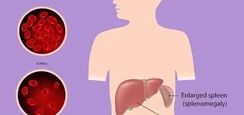 进行|肝弹数值高就是肝硬化吗？专家带您认识肝脏弹性指标！