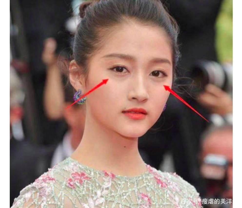 眼睛|有眼袋，20岁的小仙女也会被拖累成老阿姨！