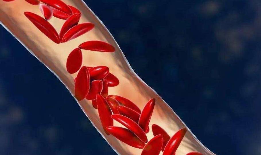 因为|烧自来水后的“水垢”,长期喝会得肾结石?答案会令你很意外!