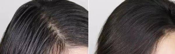 发型|杨紫为拍戏换油头发型，秀发贴头皮还没有刘海，成熟造型也很美