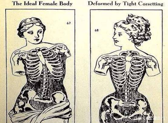 紧身衣|衣服能“杀人”：曾要人性命的西方“高端时尚”是怎样的？？