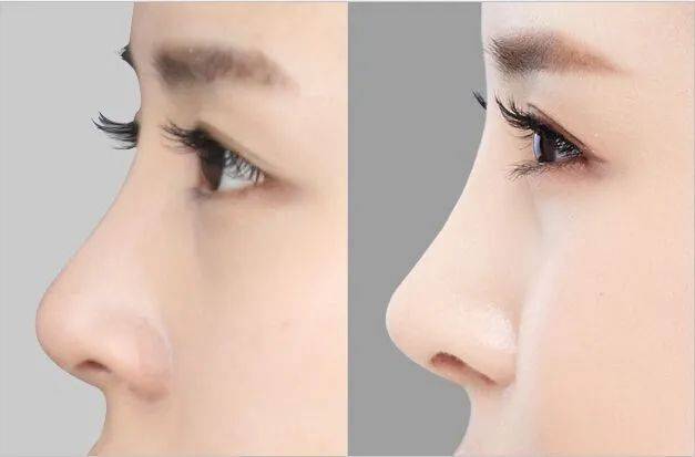 眼睛|魅惑狐系脸偏要做幼态眼睑下至？别再跟风微整啦，看看你是什么样的动物系长相