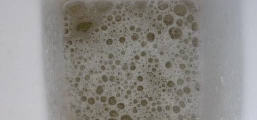 控制|血糖升高的人，若有了“这种”表现，最好去检查一下肾脏