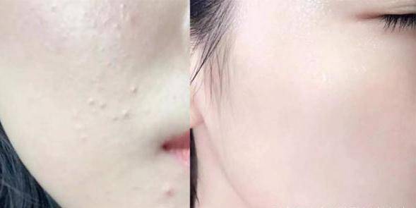 宋轶|宋轶“好皮肤”被赞,大方分享护肤经验,竟和赵露思用同款护肤品