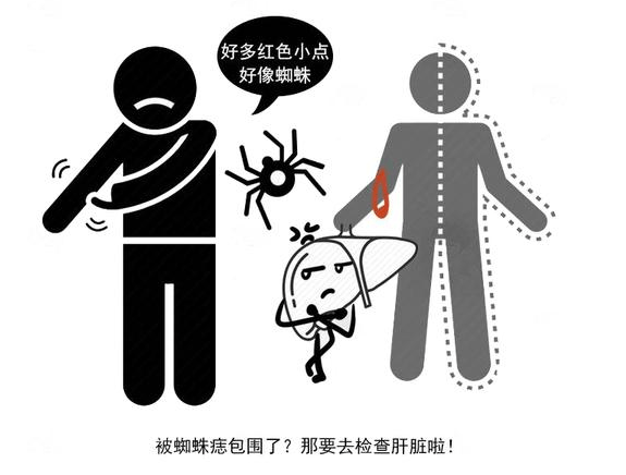 肝脏|面部出现4个“异象”，需及时就医检查，这多半是肝病上身的信号