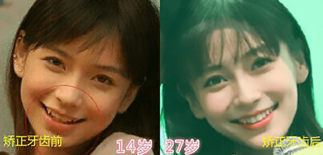 天然美女vs后天美女 女明星们的变美思路 值得普通女生借鉴 时尚街头